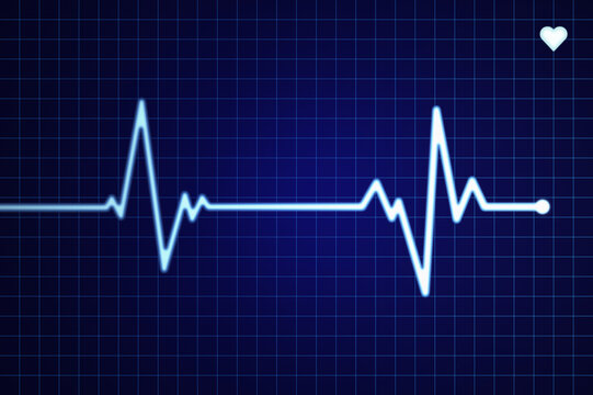 Electrocardiogram on a blue grid screen