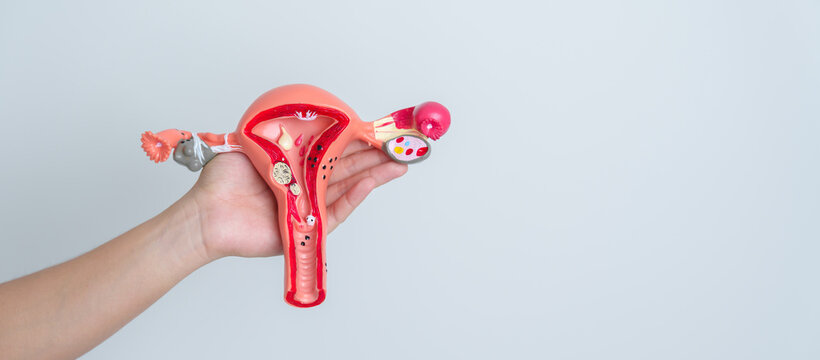 Woman holding Uterus and Ovaries model. Ovarian and Cervical cancer, Cervix disorder, Endometriosis, Hysterectomy, Uterine fibroids, Reproductive system and Pregnancy concept