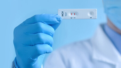 A doctor wearing protective mask and gloves shows a rapid laboratory test for hepatitis C virus (HCV) . The test shows a positive result. - obrazy, fototapety, plakaty