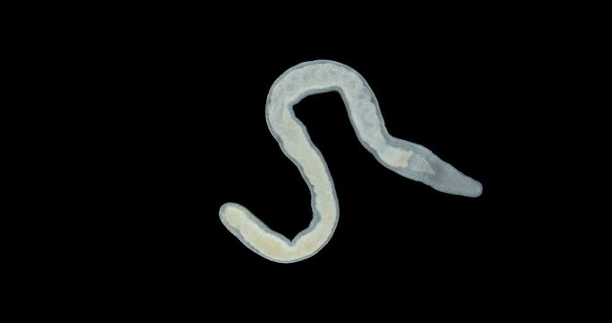 Nemertea worm under a microscope, class Hoplonemertea, order Monostilifera. The specimen was found in the White Sea.