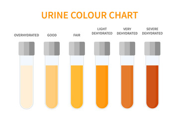 Urine colour chart. Hydration and dehydration level diagram. Medical urinal test kit for urinary tract infection research. Containers with yellow to brown pee for urinalysis. Vector illustration.