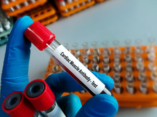 Cardiac Muscle Antibody test, these ABs are found in the post-myocardial infarction, Dressler's...
