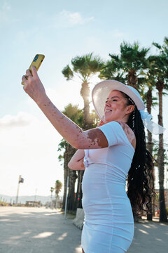Woman with vitiligo taking selfies with a mobile phone standing outdoors near palm trees.