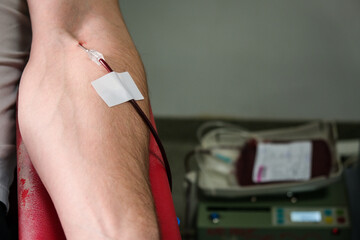 Detail with hand of a blood donor donating blood in a hospital