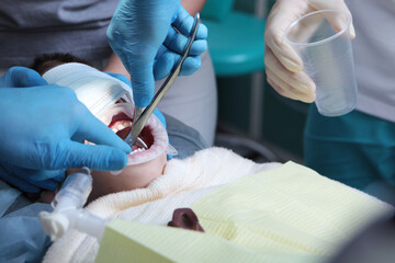Treatment of baby teeth. Installation of crowns on baby teeth. The child is under general...