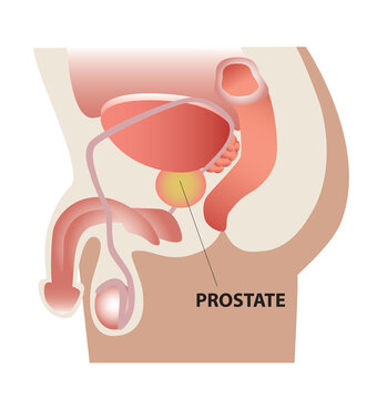 Prostate - Pr&oacute;stata