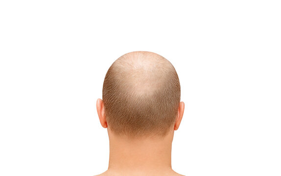 Male head from back of head, sparse hair and receding hairline, isolated on white background with clipping path