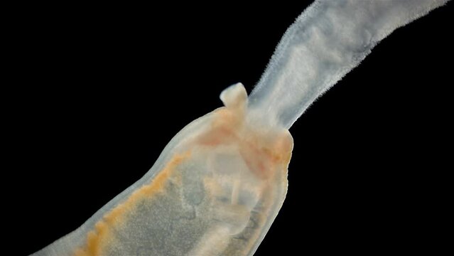 Worm Arctostemma arcticum under the microscope, phylum Nemertea, order Monostilifera. You can see the proboscis and stylet. White Sea.