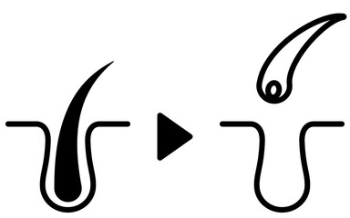 脱毛の毛穴断面、脱毛クリニック・脱毛サロンのイメージイラスト