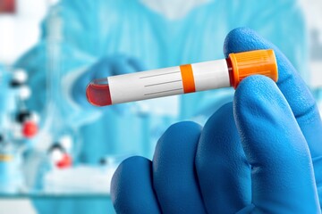 Doctor's hand hold a test tubes