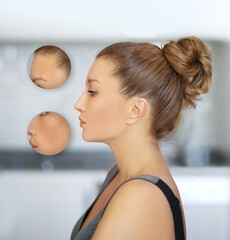 Dark spots, freckles,hyperpigmentation(melasma or chloasma),concept - skin lightening, skin whitening, fruit acids,AHA, Skin Brightening