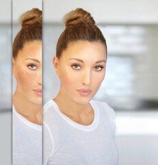 Dark spots, freckles,hyperpigmentation(melasma or chloasma),concept - skin lightening, skin whitening, fruit acids,AHA, Skin Brightening