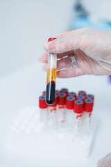 Blood is collected in a medical tube for analysis. Blood for medical research