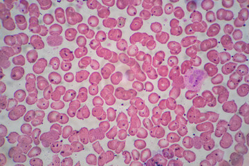 Human blood cells, Blood group and white blood cell study under microscopic.