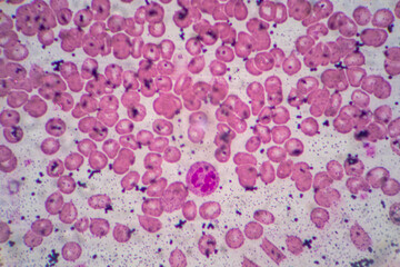 Human blood cells, Blood group and white blood cell study under microscopic.