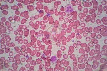 Human blood cells, Blood group and white blood cell study under microscopic.