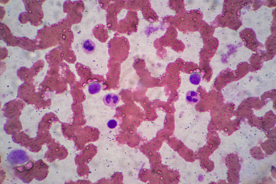 Human blood cells, Blood group and white blood cell study under microscopic.