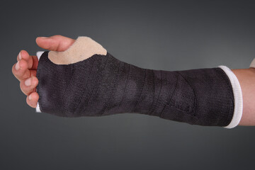 Broken hand wrapped in a black cast