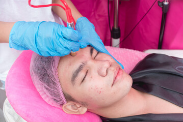 An Esthetician performs a Diamond peel facial, a type of microdermabrasion procedure. Exfoliating the forehead and face. At a aesthetic or dermatology clinic.