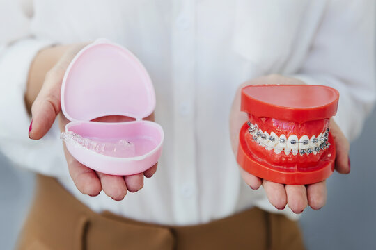 woman holding professional orthodontic denture with metal braces and removable invisible aligner. Comparation of two dental straighten treatments