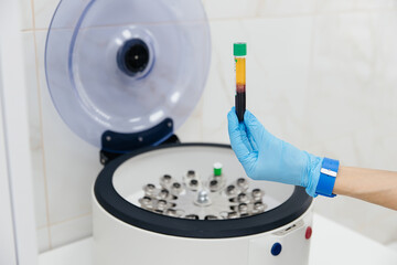 Tube with blood in hands. Centrifuge. Background