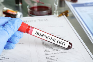 Doctor holding glass tube with blood sample and label Hormone Test at table, closeup