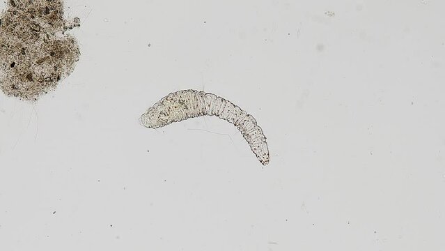 Aeolosoma (minute annelid worm) under the microscope - light microscope x100 magnification