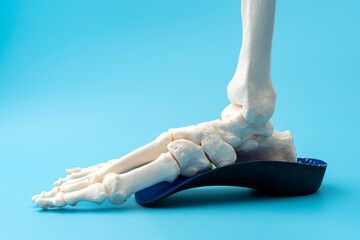Anatomical model of the bones of the human foot wearing an orthopedic insole concept for Physical therapy for leg injury, Skeletal anatomy model benefits and Joint pain relief techniques - 572132396