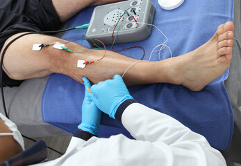 Electromyography in the lower limbs, graphic recording technique of the electrical activity produced by the tibial muscle performed by a specialist neurologist
