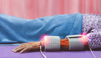 Stroke treatment, patients use electric stimulation tools to treat the arm, stimulation, medical...