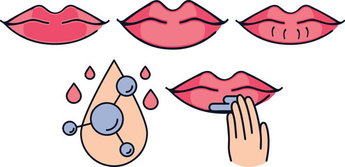 Set of lips problem illustration