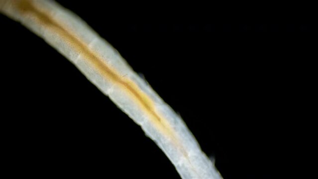 Polychaeta worm, order Sabellida under a microscope. Filters living in tubes of sand, shell fragments, glued together with mucus. Possibly family Fabriciidae. Barents sea