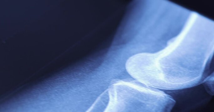 Closeup of different x-ray images on the table