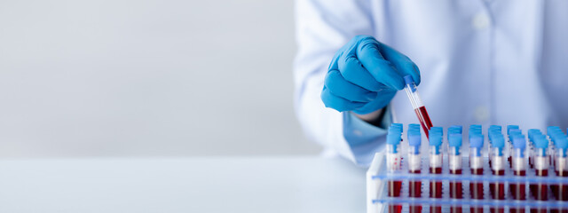 Lab assistant, a medical scientist, a chemistry researcher holds a glass tube through the blood...