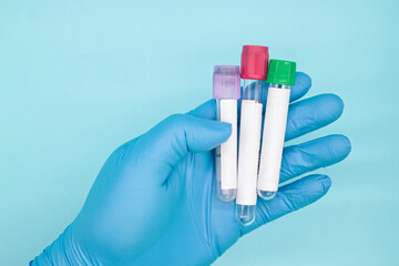 hand in medical glove holding three vacuum tubes for collection blood samples on blue background