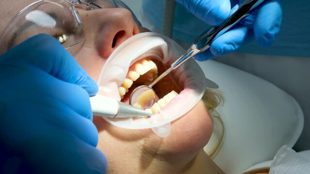 close-up woman dentistry brushing teeth cleaning removing plaque stones saliva ejector using oral mirrors newest technology sandblaster goggles water drops spilling to sides optragate mouth expander