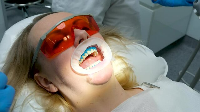 liquid cofferdam to isolate gums from action of bleaching agent optragat rotary spreader woman open mouth from doctor in dentistry with saliva ejector takes away excess saliva in protective glasses