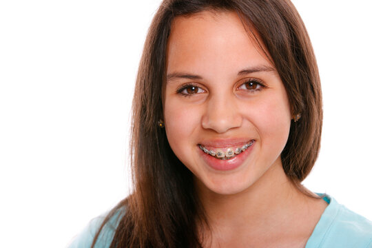 Studio portrait of teenage girl wearing braces and smiling in front of white background.