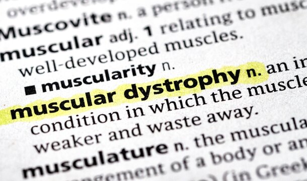 muscular dystrophy