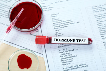 Hormone test. Sample tube with blood and laboratory form on table, flat lay