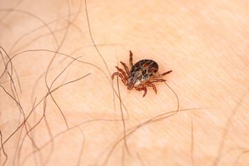 dangerous blood-sucking insect. small brown spotted mite, biological name Dermacentor reticulatus on human skin