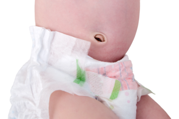 A newborn child with a recently fallen off umbilical cord, a sore healing on the navel, isolated on a white background. Kid age 0 months
