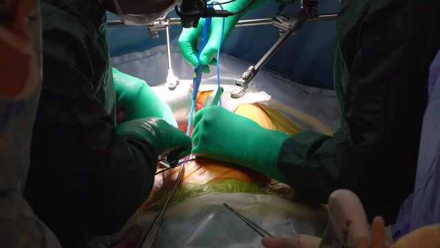 Surgeons perform heart surgery with special magnifying operating glasses in the operating room