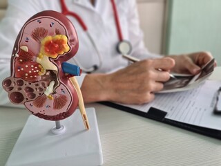 Urology and treatment of kidney diseases. Doctor analyzes patient kidney health with kidney...