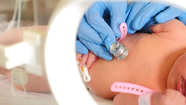 Closeup little newborn baby infant in incubator for newborns, Newborn baby having breathing problem after birth, newborn in NICU, Neonatal intensive care unit, healthcare. 4 k video