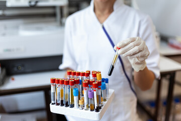 doctor hand taking a blood sample tube from a rack with machines of analysis in the lab background...