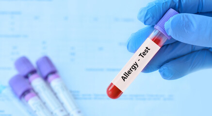 Doctor holding a test blood sample tube positive with allergy test on the background of medical test tubes with analyzes.