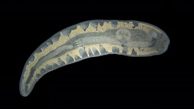Nemertea worm Monostilifera gen. sp. under a microscope, class Hoplonemertea. Sexually mature, size 3-3.5 mm. The specimen was found in Barents Sea.