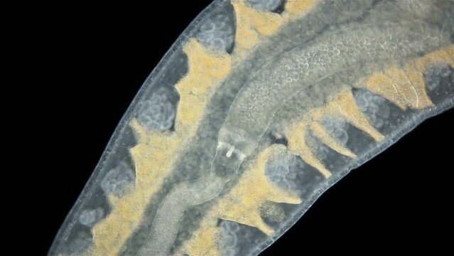 Nemertea worm Monostilifera gen. sp. under a microscope, class Hoplonemertea. Sexually mature, size 3-3.5 mm. You can see the proboscis and stylet. Barents Sea.