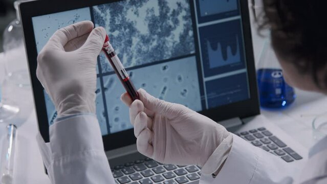 Close-up of doctor in gloves holding test tube with blood inside, she examining it during scientific experiment in the lab